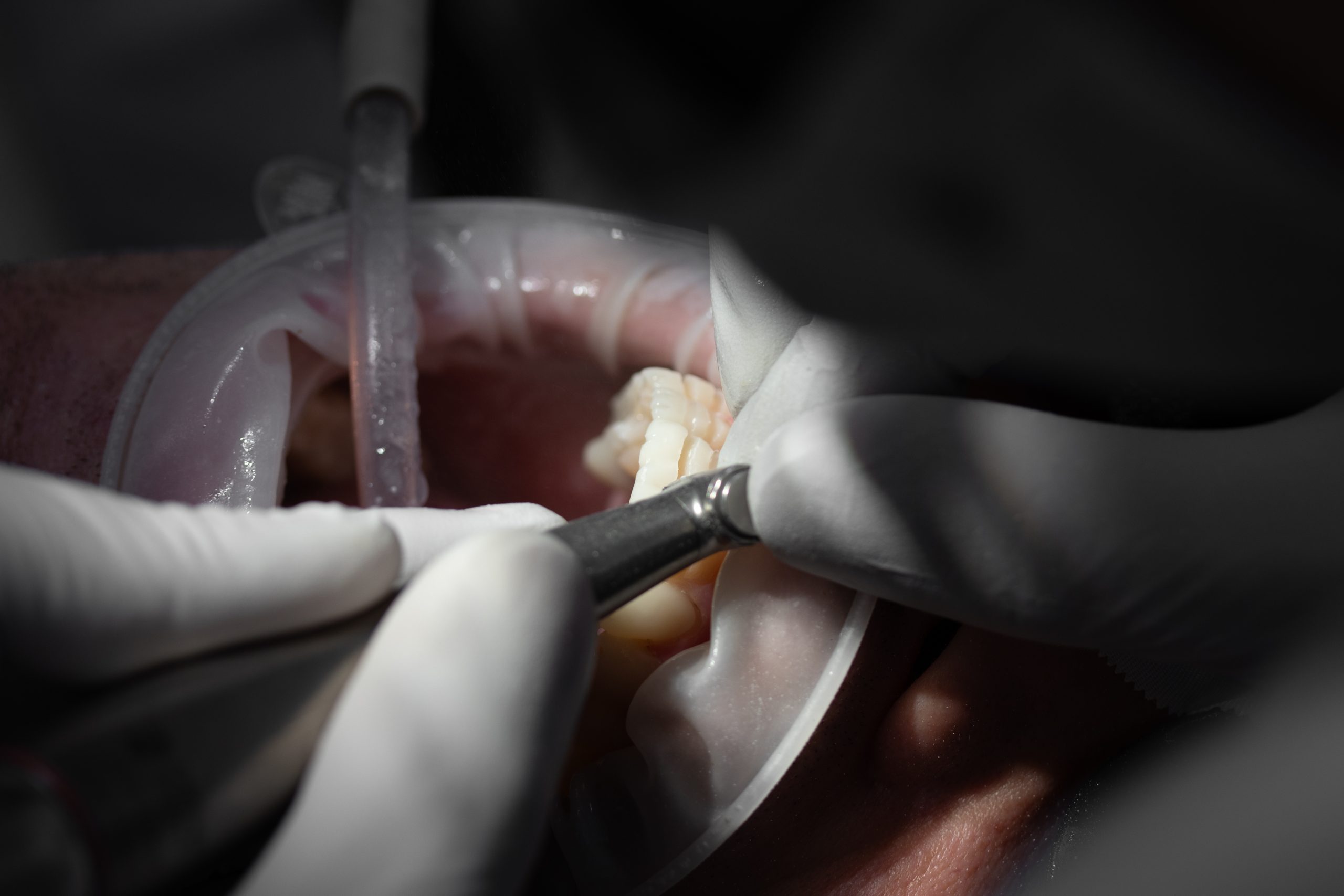 Estetica Dentară