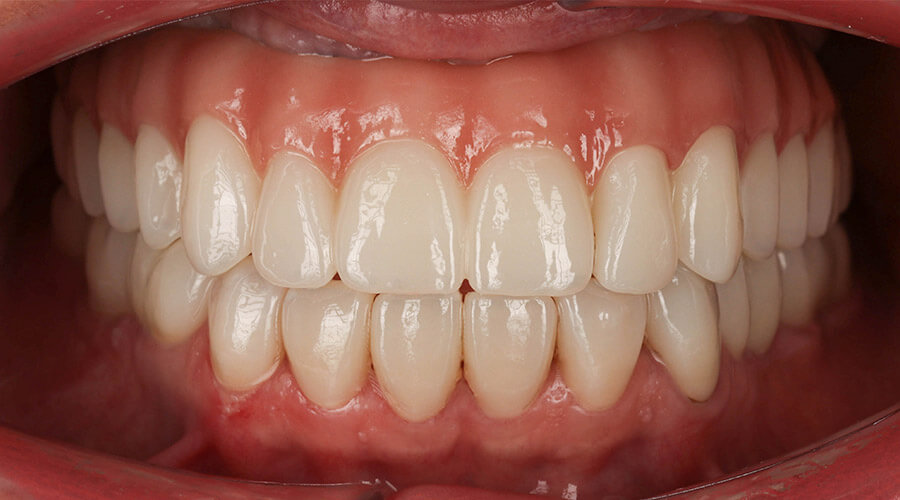 Mitachi Dental Health