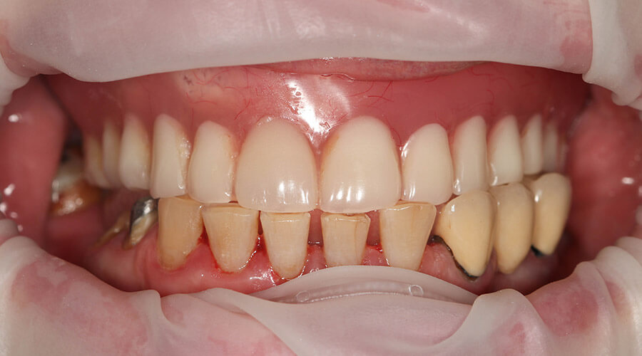 Mitachi Dental Health