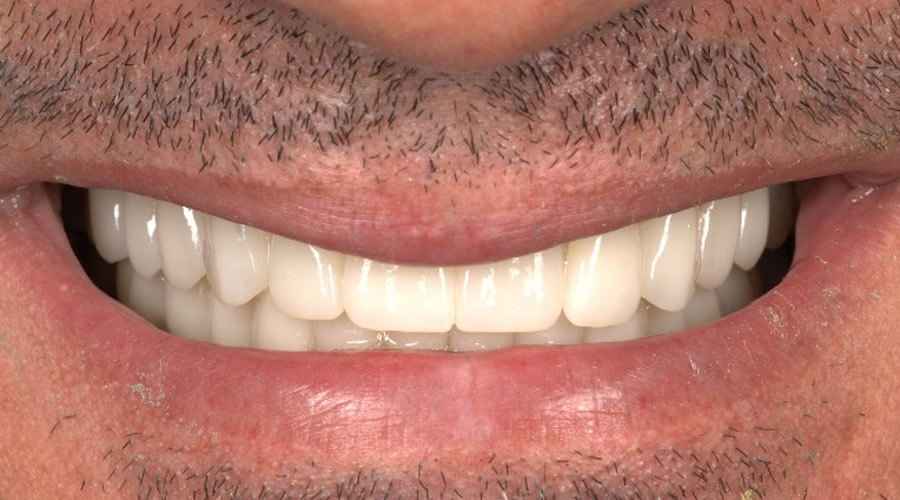 Mitachi Dental Health