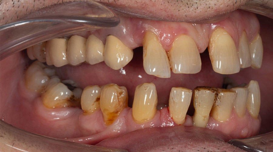 Mitachi Dental Health