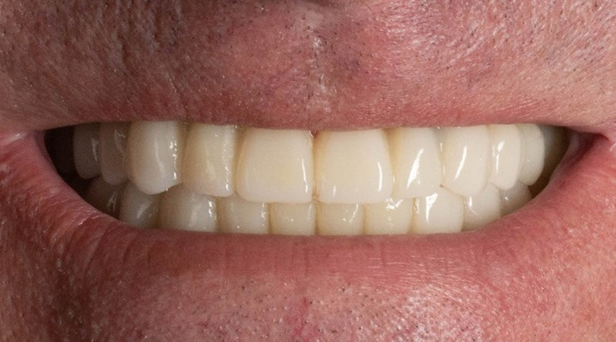 Mitachi Dental Health