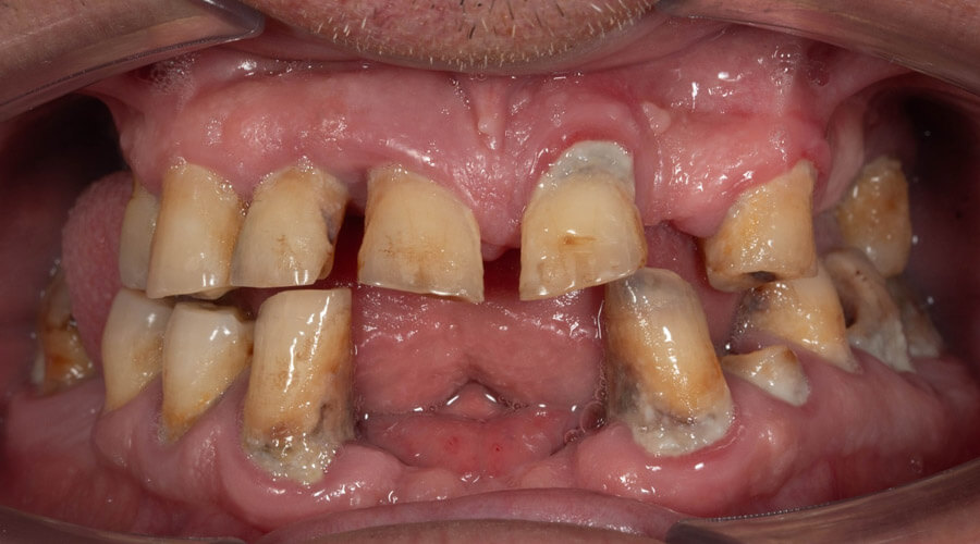 Mitachi Dental Health