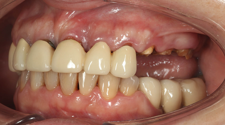 Mitachi Dental Health