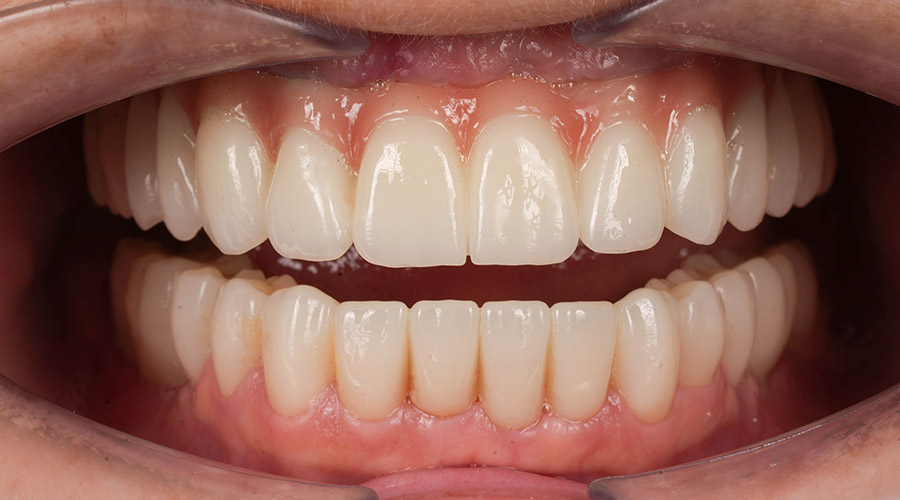 Mitachi Dental Health