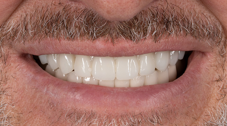 Mitachi Dental Health