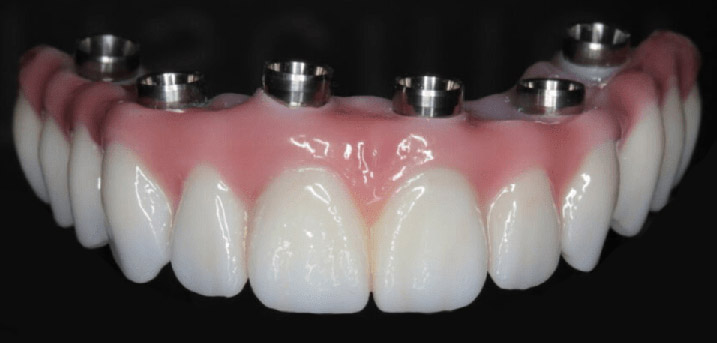 Mitachi Dental Health