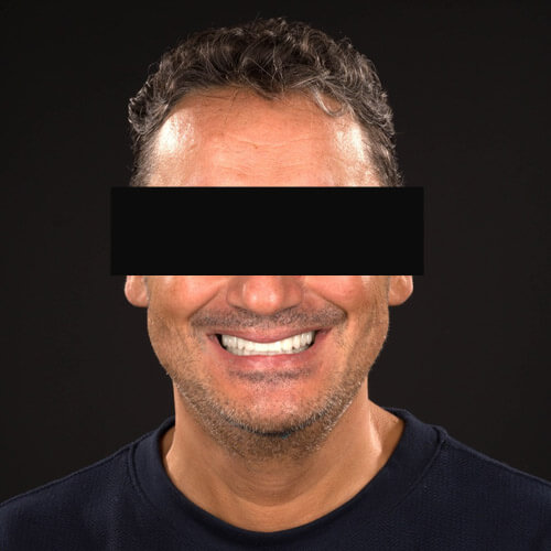 Mitachi Dental Health