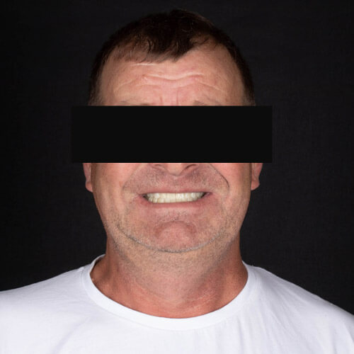 Mitachi Dental Health