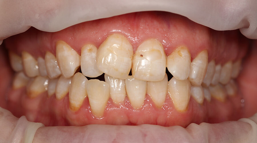 Mitachi Dental Health