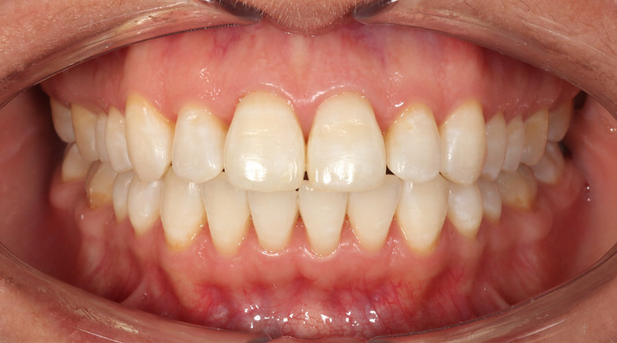 Mitachi Dental Health