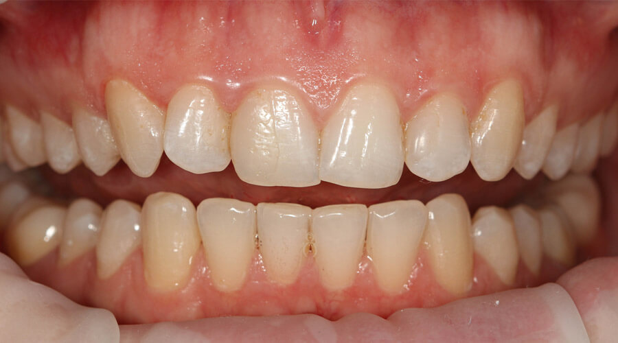 Mitachi Dental Health