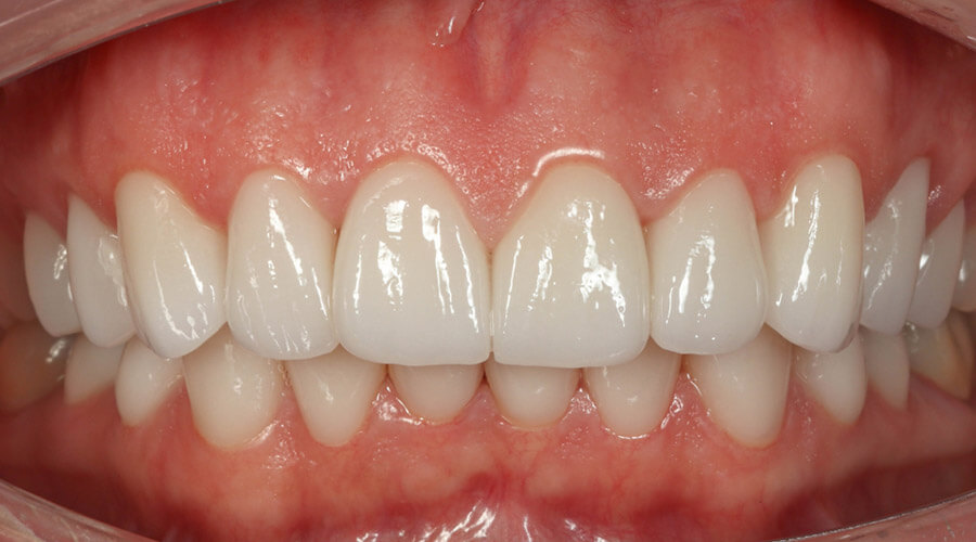 Mitachi Dental Health