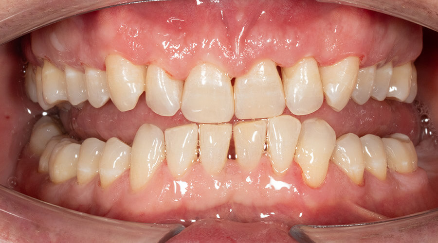 Mitachi Dental Health