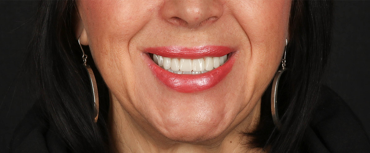 Mitachi Dental Health